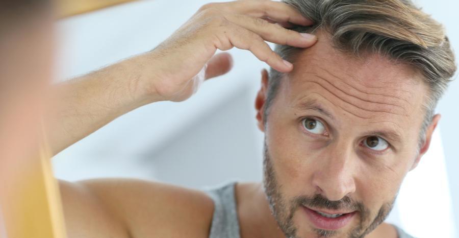 man examining his hair line