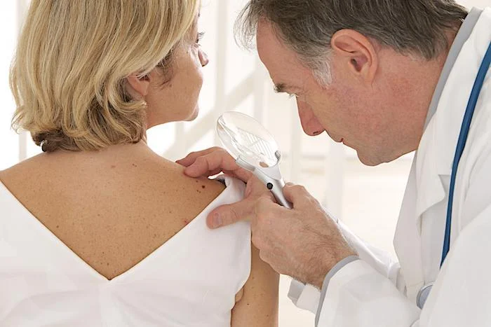 Are You at Risk for Skin Cancer?