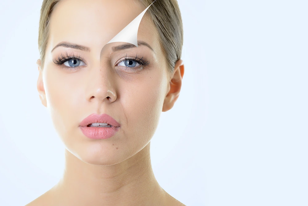 How Do Chemical Peels Work?