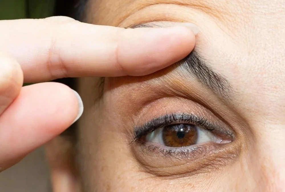 Surgery Isn’t the Only Solution for Saggy Eyelids. Try Upneeq® for a Noninvasive Lift