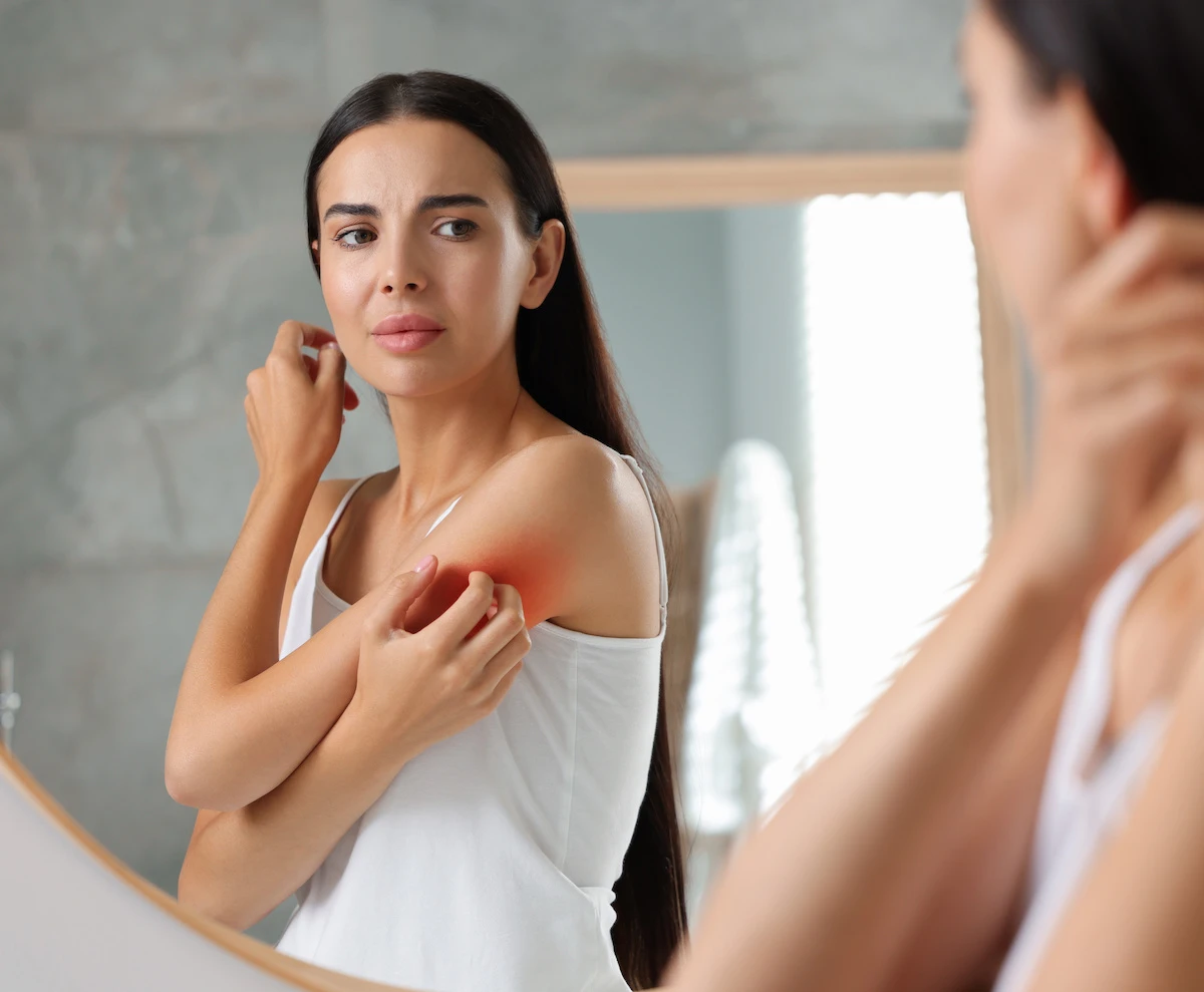 woman looking in the mirror at the eczema on her arm