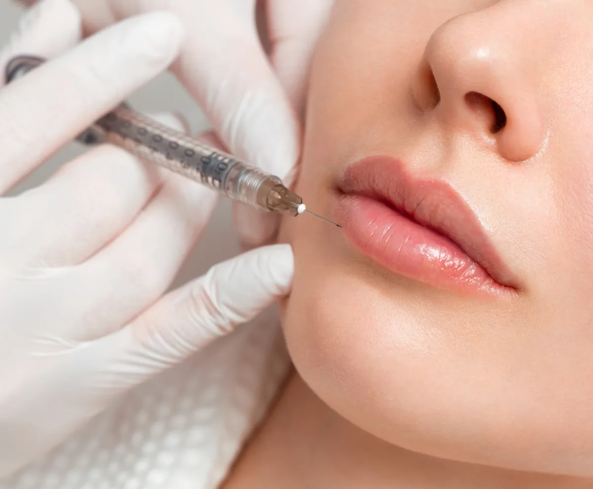 patient during lip filler procedure