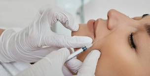 smile lines treatment