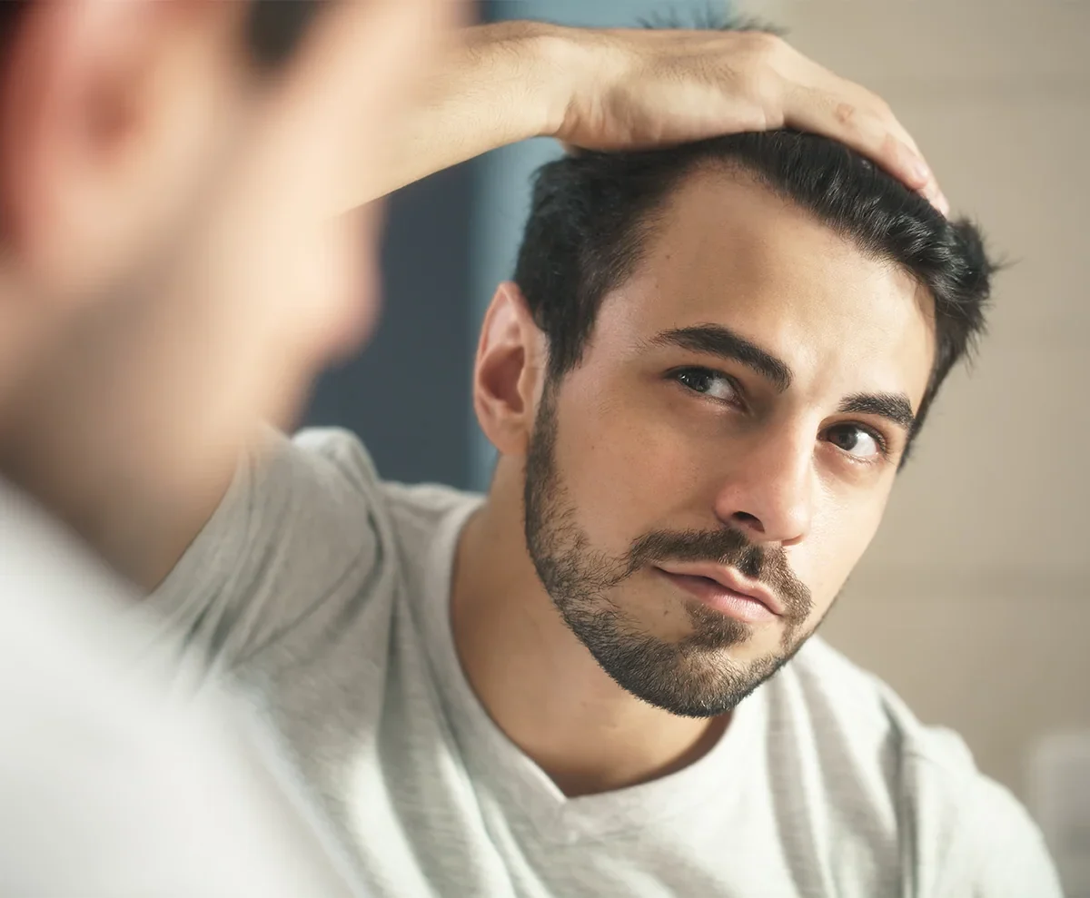 man in 30's looking at thinning hairline in mirror