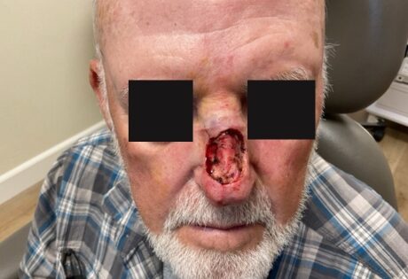 Case # 32 before photo