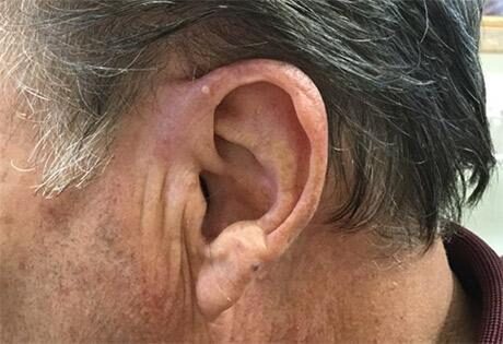 Case # 1 after photo