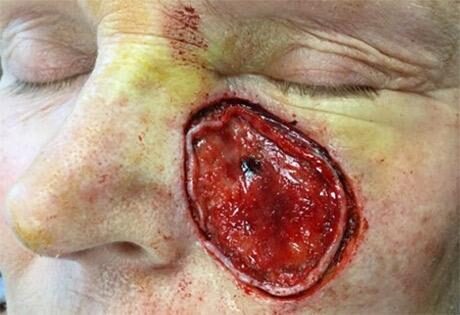 Case # 2 before photo