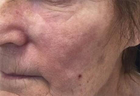 Case # 2 after photo