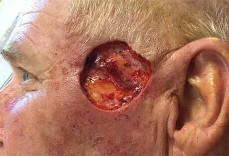 Case # 3 before photo