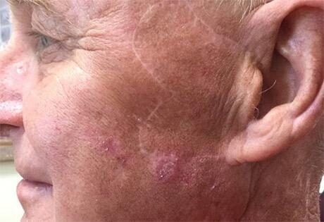 Case # 3 after photo