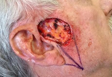 Case # 4 before photo