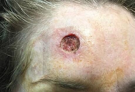 Case # 5 before photo