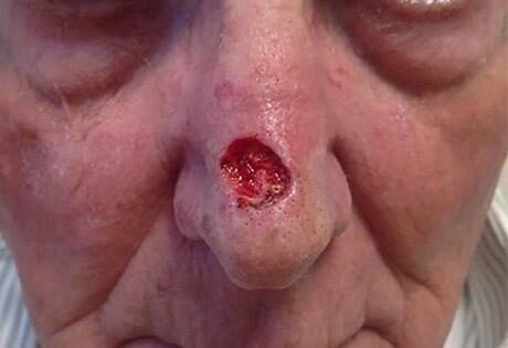 Case # 6 before photo