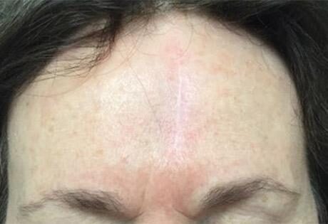 Case # 7 after photo