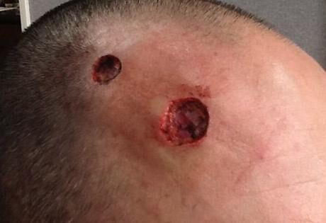 Case # 8 before photo