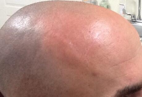 Case # 8 after photo