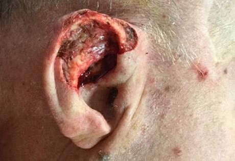 Case # 10 before photo