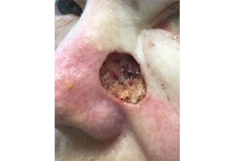 Case # 11 before photo