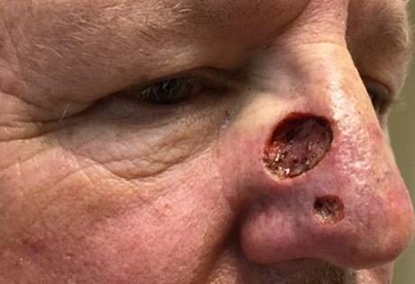 Case # 12 before photo