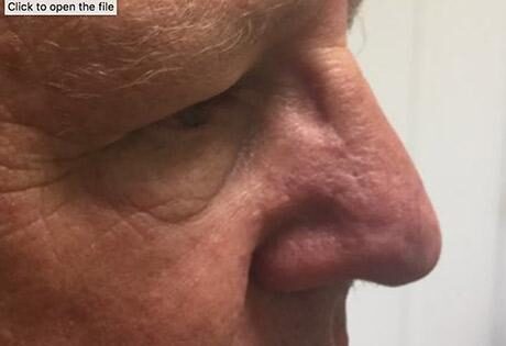 Case # 12 after photo