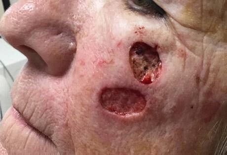 Case # 13 before photo