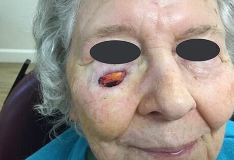 Case # 14 before photo