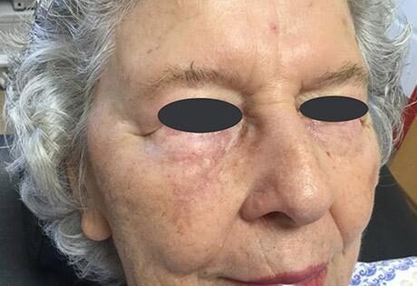 Case # 14 after photo