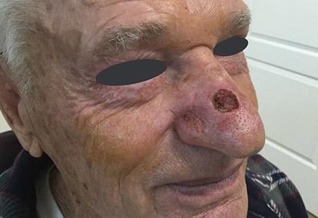 Case # 15 before photo