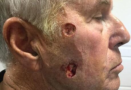 Case # 16 before photo