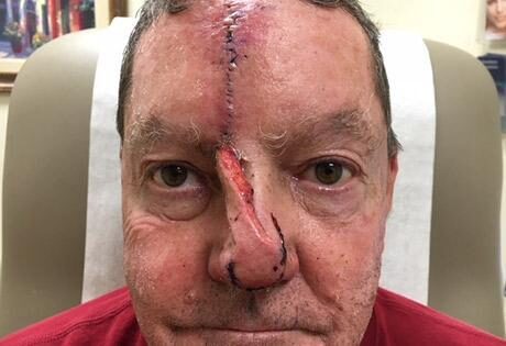 Case # 17 before photo