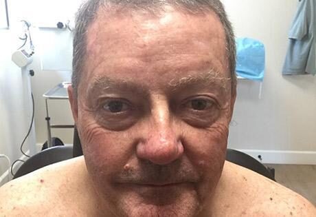 Case # 17 after photo