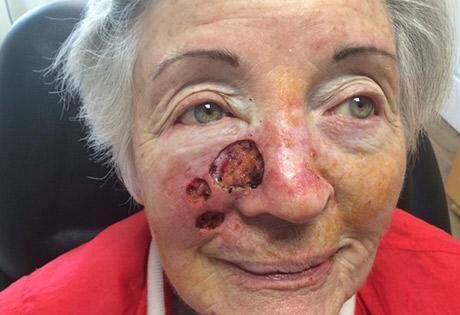 Case # 18 before photo