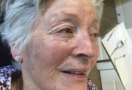 Case # 18 after photo