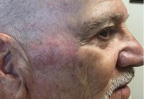 Case # 19 after photo