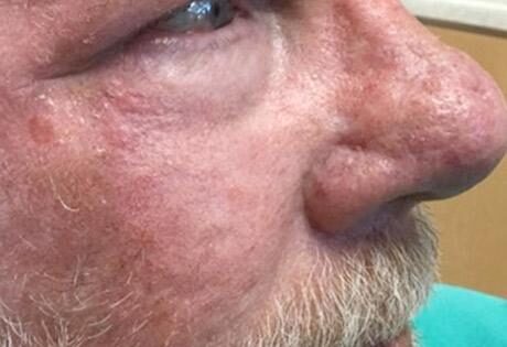 Case # 21 after photo