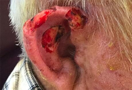 Case # 22 before photo