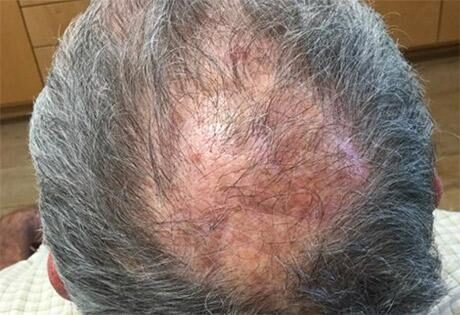 Case # 24 after photo