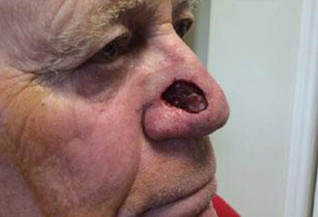 Case # 25 before photo