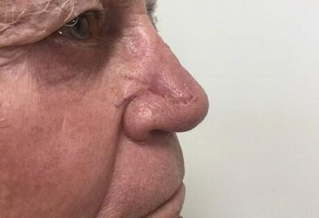 Case # 25 after photo