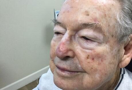 Case # 26 after photo