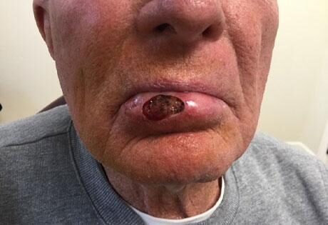 Case # 27 before photo