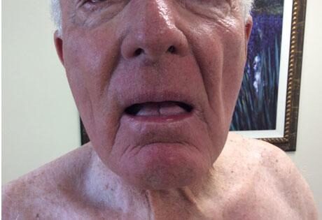 Case # 27 after photo