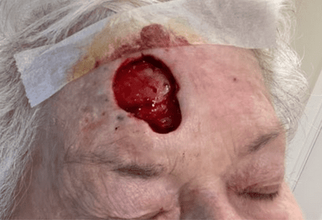 Case # 30 before photo