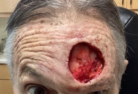 Case # 31 before photo