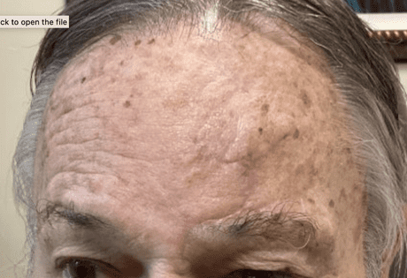 Case # 31 after photo