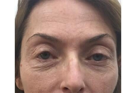 Case # 2 before photo