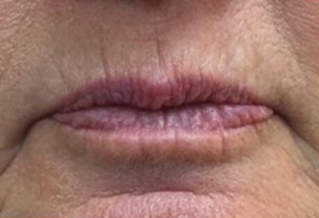 Case # 1 before photo