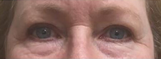 Case # 3 before photo