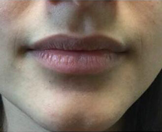 Case # 4 before photo