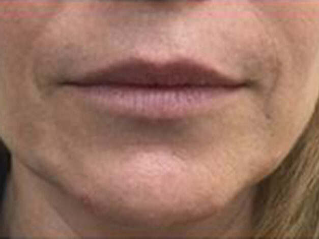 Case # 6 before photo